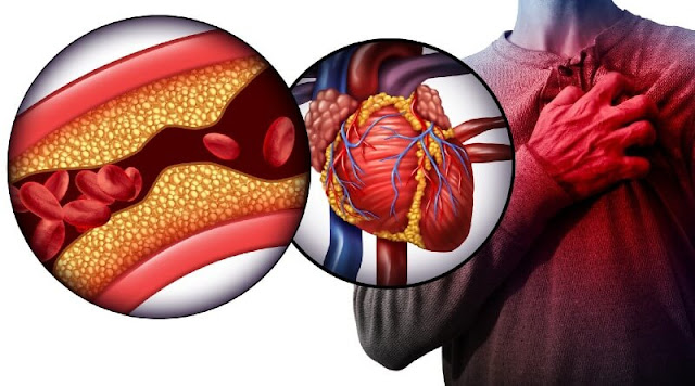 The Most Dangerous Heart Diseases: Understanding the Risks and Prevention