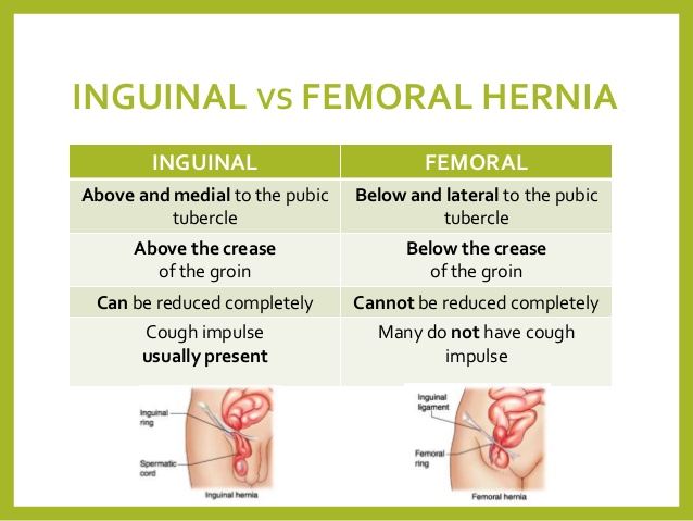 Study Medical Photos: Brief Description Of Abdominal Wall Hernias