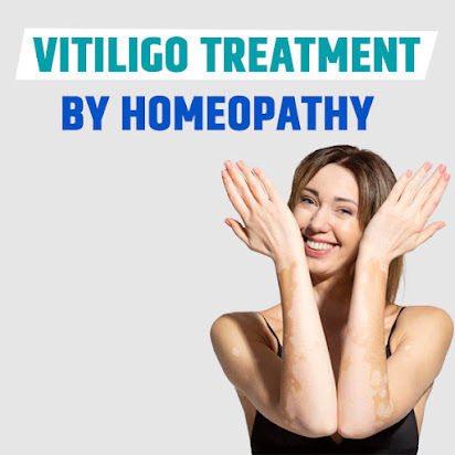 homeopathic vitiligo treatment