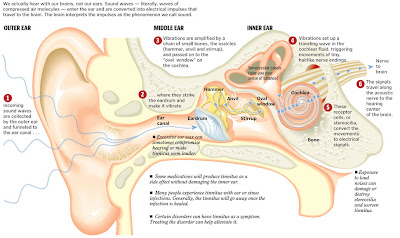 Neurostimulation Tinnitus : Cure Tinnitus-hearing Aids