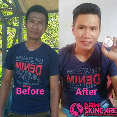 Drw Skincare Untuk pria