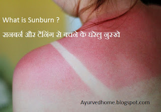 why sunburn in hindi 