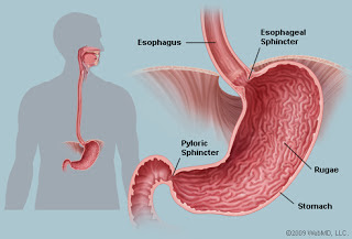 Pedih Ulu Hati/Reflux (GERD) ~ seribupilihan