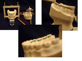 Escultura dental Incisivo Central Dicas OdontoDicas Odonto