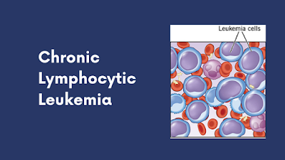 Chronic Lymphocytic Leukemia