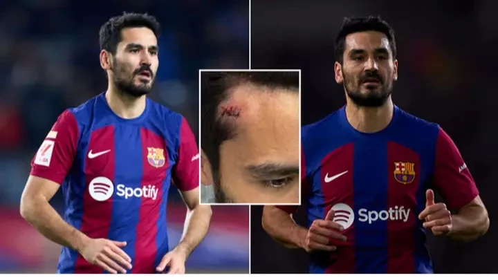 Ilkay Gundogan forced to spend time in hospital to end 2023 after bizarre incident