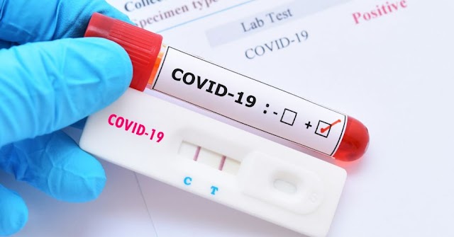 Para este lunes se reporta 1 fallecido 21 recuperados y 13 nuevos contagios de la COVID-19 en Goicoechea