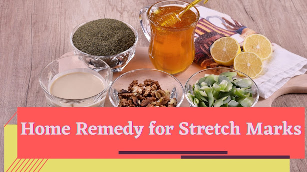 stretch marks home remedy