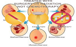 Breast Cancer Surgery and Treatment