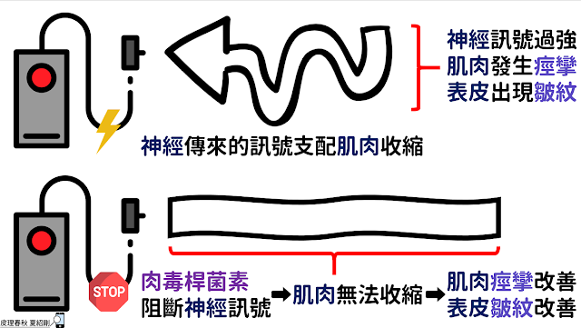 肉毒桿菌素的作用機轉-皮理春秋