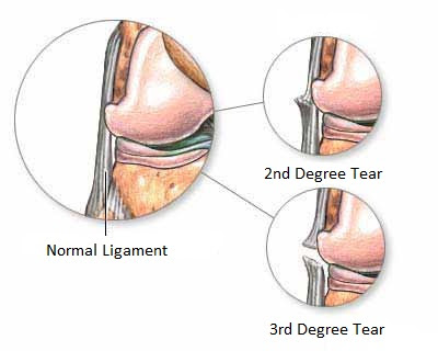 Orthopedics in Mumbai