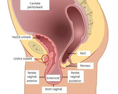 Anatomia prolapsului