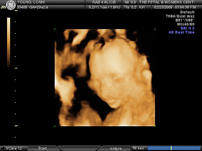 3d ultrasound pictures at 12 weeks. 3D Ultrasound Pictures of Our