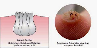 obat penyakit mata ikan