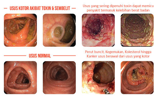 PSYLLIUM HUSK - KuruS Penyelesai Masalah