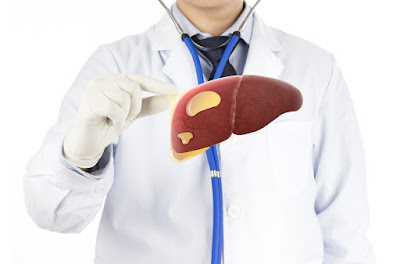 Liver Transplant