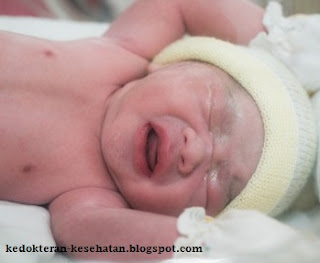Kondisi yang Membutuhkan Resusitasi Bayi Baru Lahir
