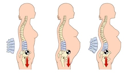 Bentuk tulang punggung selama kehamilan