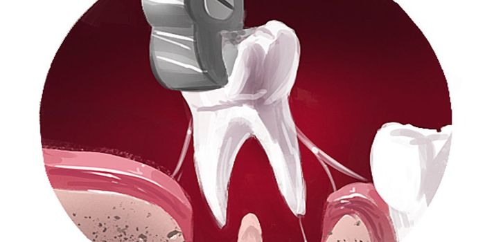 Cirurgia Oral