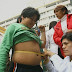 ISEM dará tratamiento gratuito a niños diagnosticados con sobrepeso y obesidad