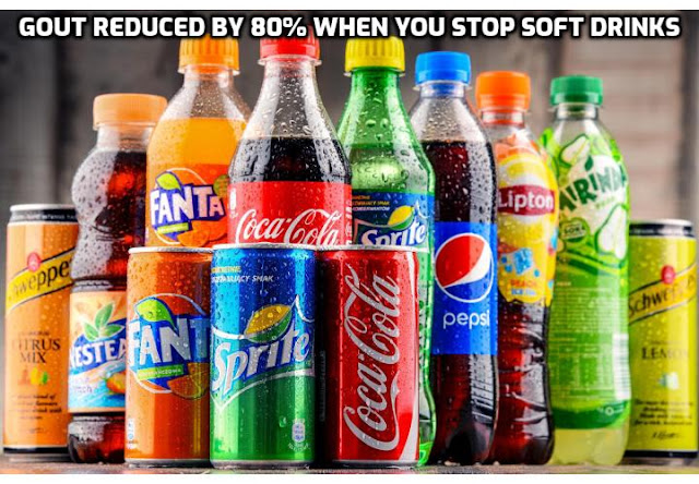 Do you want the secret to get rid of gout fast in 2 hours or less? Gout attacks, according to a study by The University of British Columbia and Harvard Medical School published in the British Medical Journal, are increased by sugary drinks and fructose, such as soft drinks. To get rid of gout fast, you therefore need to avoid sugary drinks.