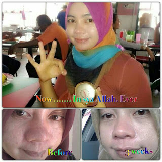 Testimoni Firmax3 Cream