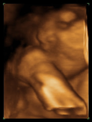 3d ultrasound scan. 3d ultrasound pictures