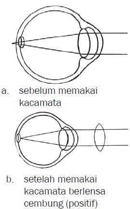 Alat Optik Mata dan Kacamata serta Mekanisme Proses 