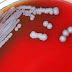 La peligrosa bacteria encontrada en EE.UU. que preocupa a las autoridades de salud del país