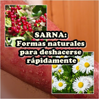 https://natwiki.blogspot.com/2018/07/sarna-formas-naturales-para-deshacerse.html