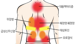 오른쪽 등통증 부위별 원인