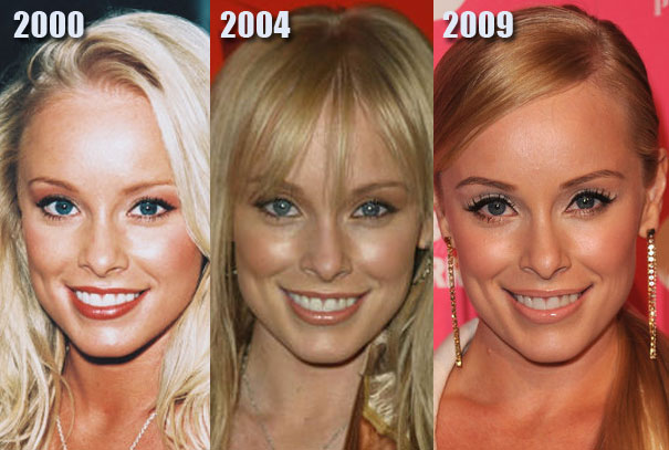 New Celebrity Buzz Jaime Bergman Plastic Surgery Rumors New Celebrity Buzz Jaime Bergman Plastic Surgery Rumors