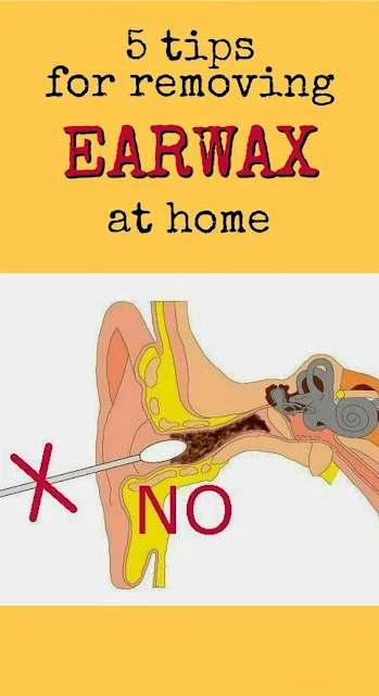 How to Safely and Properly Remove Earwax at Home: Tips and What to Avoid