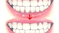 Gnashing Teeth While Sleeping