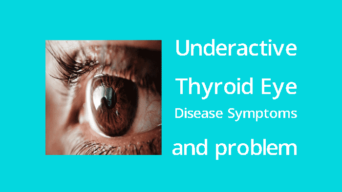 underactive thyroid eye disease symptoms