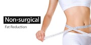 Non Surgical Fat Reduction Treatments