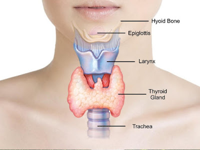 থাইৰয়ডৰ কাৰন, লক্ষণ, চিকিৎসা আৰু ঘৰুৱা প্ৰতিকাৰ - Thyroid Causes, Symptoms and Home Remedies In Assamese 