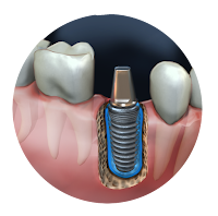 Editorial Teeth 