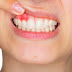 3 mẹo chữa sưng phồng chân răng hiệu quả