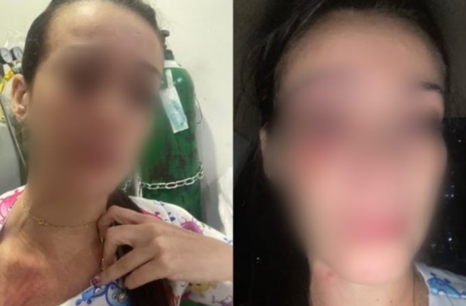 Enfermeira é agredida ao tentar prestar atendimento a adolescente em Hospital de Rondônia
