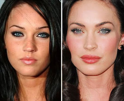 megan fox plastic surgery