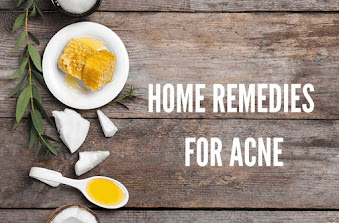 Home Remedies for Acne