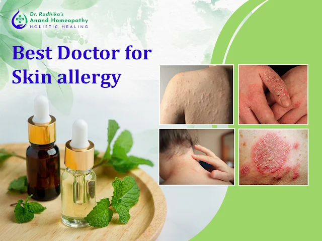 Doctors for skin allergy in HSR Layout