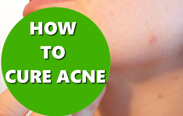 how to cure acne basichowtos.com