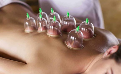 Hijama,Treatment by hijama,hijama for headaches,hijama treatment for headache hijama for cluster headache,hijama on the head benefits,cupping for headaches,hijama therapy,blog,