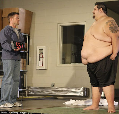 James Garrison Loses a Record-Breaking 313lbs on Extreme Makeover Seen On coolpicturesgallery.blogspot.com