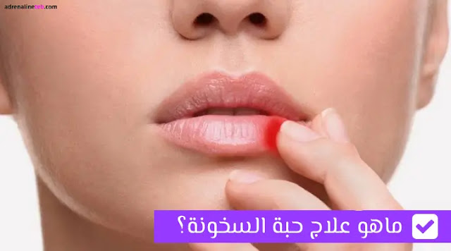 علاج حبة السخونة