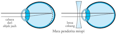 Macam Alat Optik Beserta Penjelasan dan Fungsinya Macam Alat Optik Beserta Penjelasan dan Fungsinya