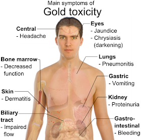 Symptoms_of_gold_toxicity