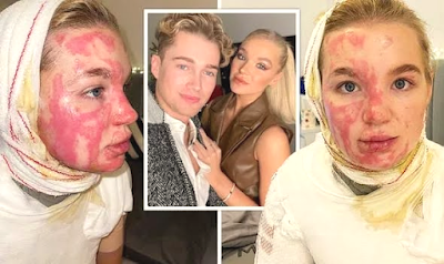 Video of Aj Pritchard's girlfriend on fire - Aj Pritchard's girlfriend on fire. Video of Aj Pritchard's girlfriend on fire - Aj Pritchard's girlfriend on fire.
